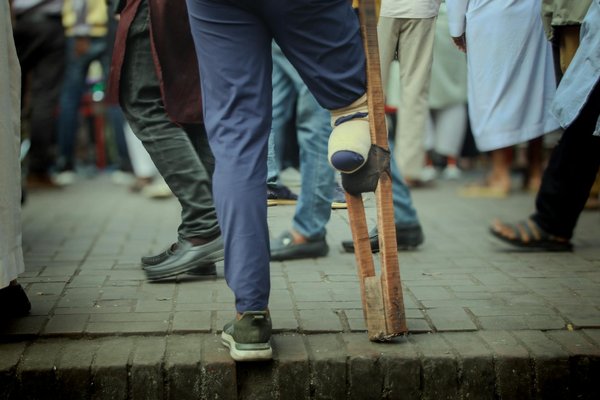 Les maladies génétiques des chats : prévention et détection